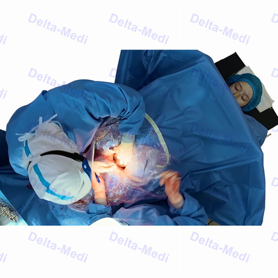 A seção cirúrgica estéril de C drapeja com a ginecologia de Obsterics da fenestração drapeja o bloco