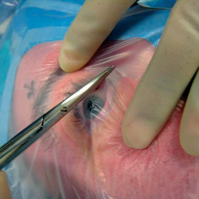 Cirúrgico estéril descartável do moldador oftálmico de Formable drapeja com suporte do cabo